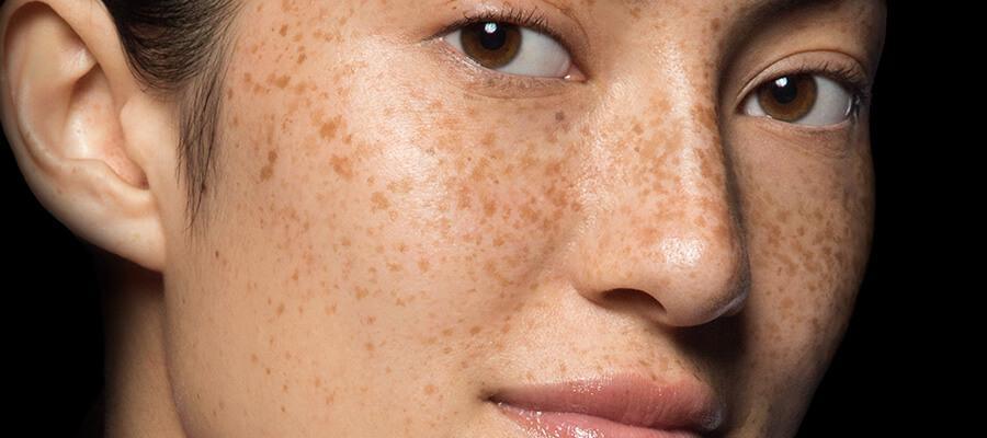 skin damage: everything you need to know – Dermalogica Singapore