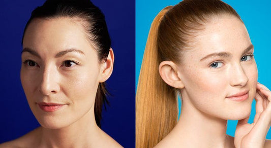 The difference between adult acne and teen acne - Dermalogica Singapore