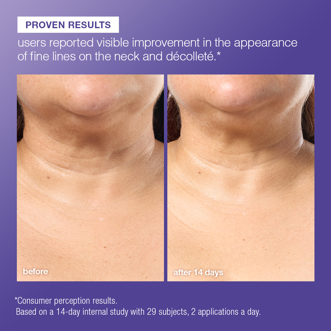 phyto nature e² regenerating daily exosome leave-on treatment