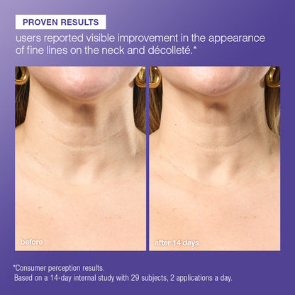 phyto nature e² regenerating daily exosome leave-on treatment