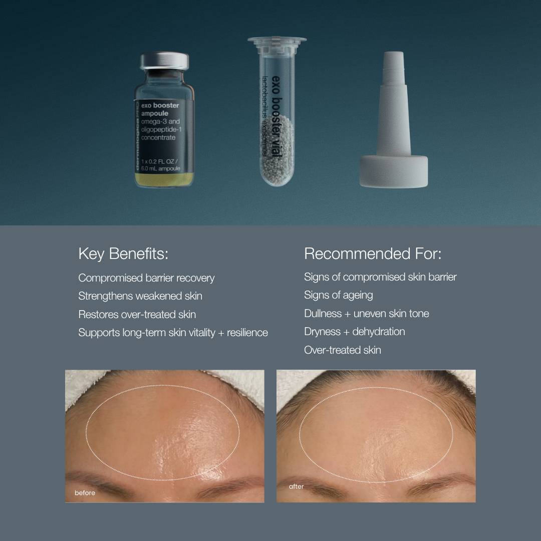 [PHYSICAL VOUCHER] Dermalogica Exo Booster Treatment