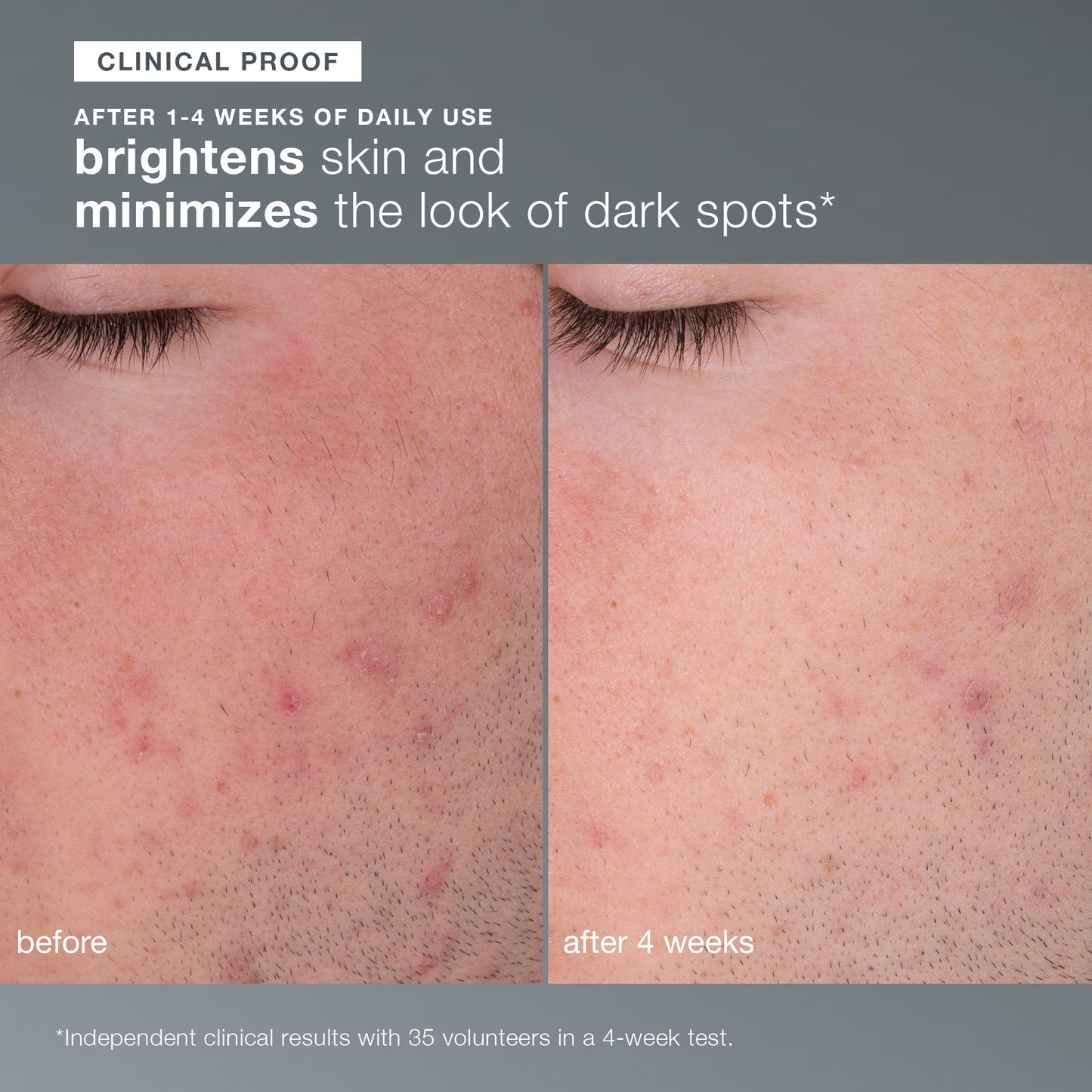 cleansing travel trio (precleanse, special cleansing gel and daily microfoliant)