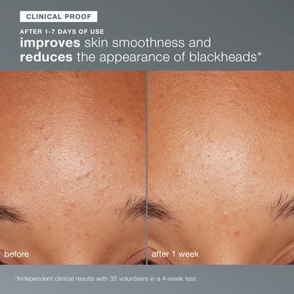 daily microfoliant exfoliator