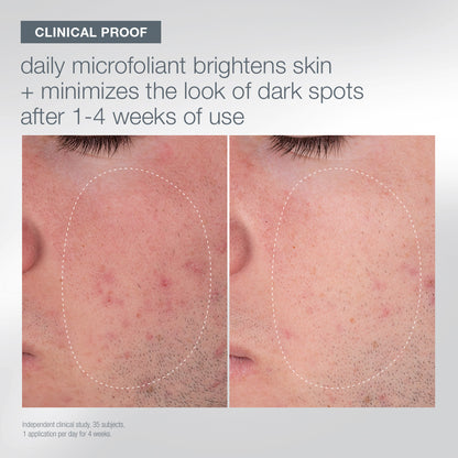 first snow of the season bundle (seasonal edition canister + refill)