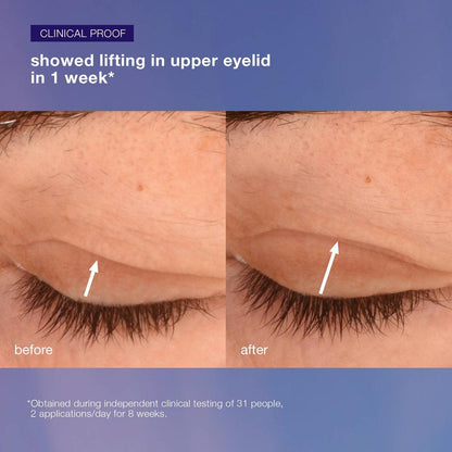 phyto nature lifting eye cream