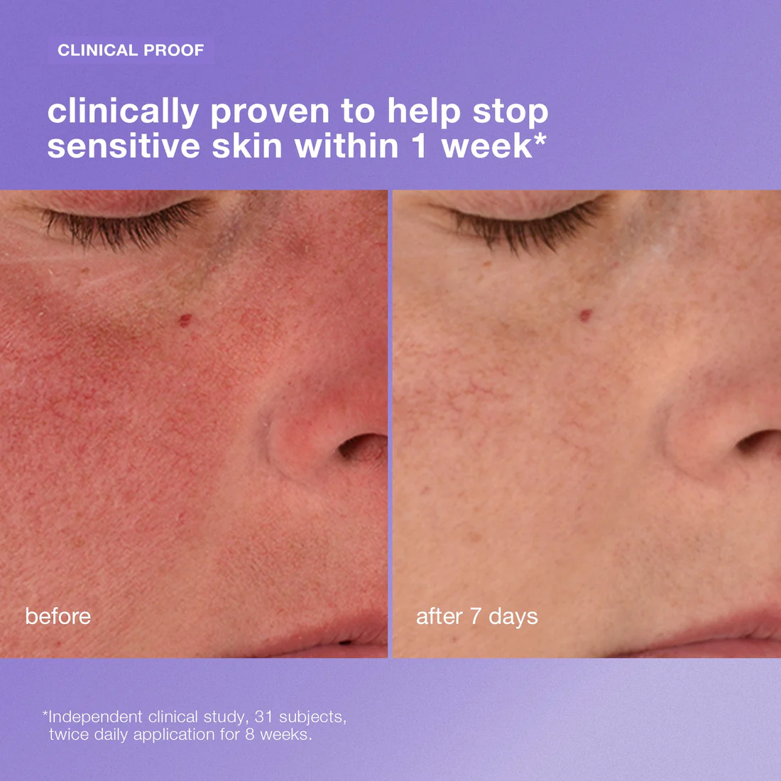 stabilizing repair cream