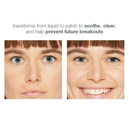 deep breakout invisible liquid patch - Dermalogica Singapore