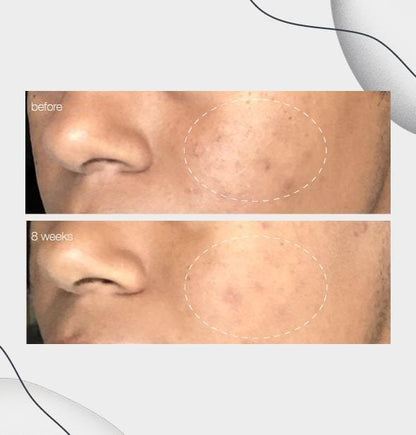 powerbright dark spot serum - Dermalogica Singapore