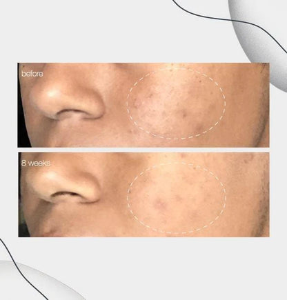 powerbright dark spot serum travel 5ml