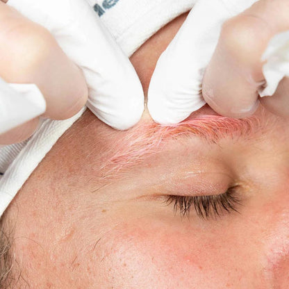 pro clear skin treatment - Dermalogica Singapore