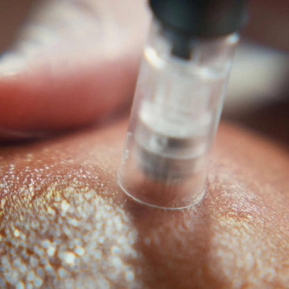 pro microneedling - Dermalogica Singapore